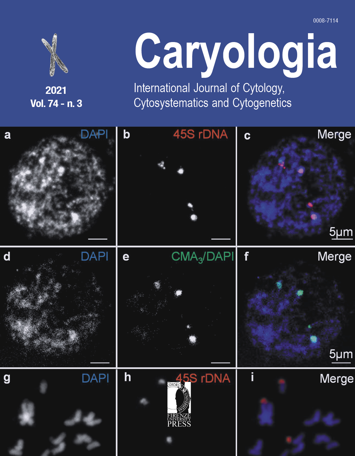 Chromomycin A3 banding and chromosomal mapping of 45S and 5S